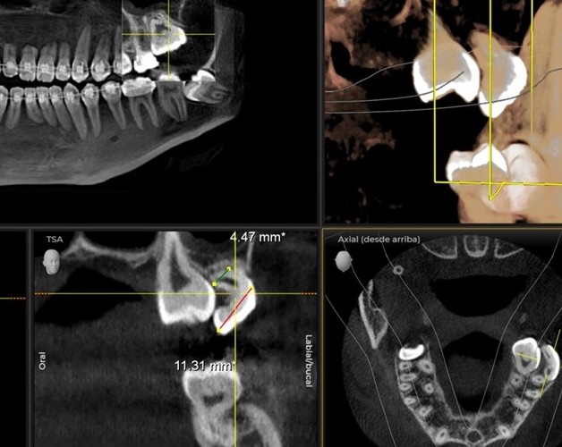 Cirugía e Implantes