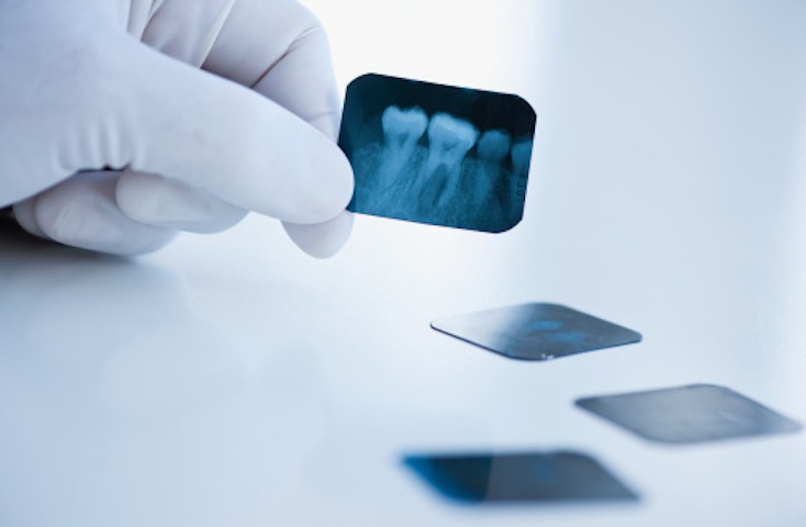 Endodoncia